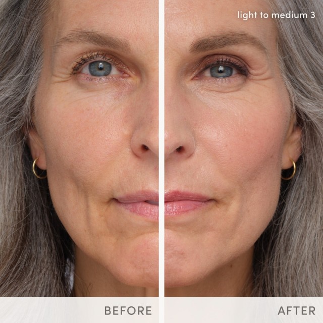 Light to medium 3